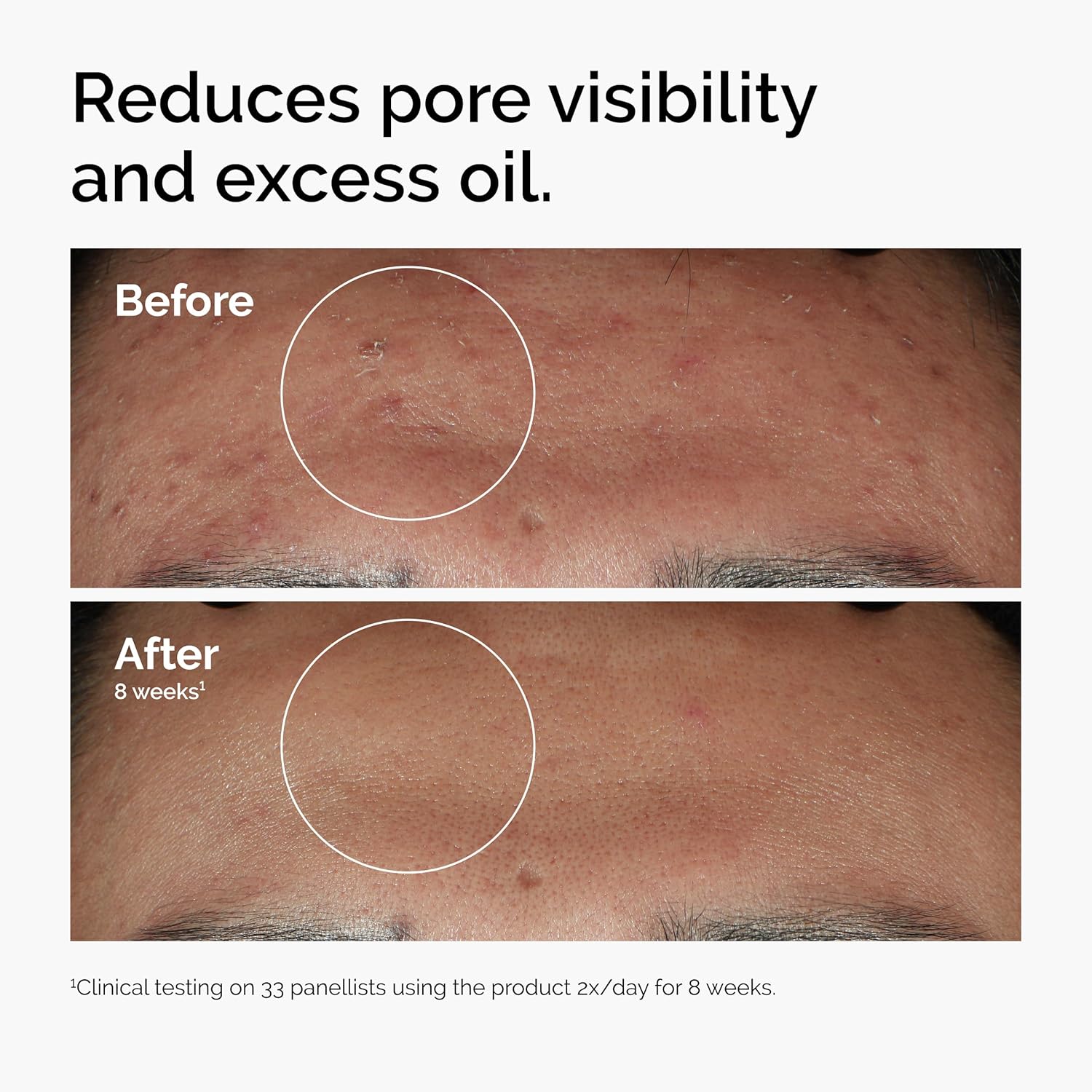 The Ordinary Niacinamide - Image 5